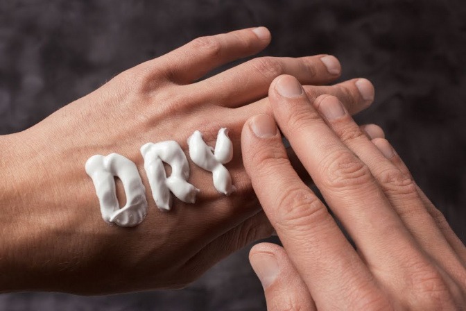 Auf einer Hand steht mit Creme "DRY".